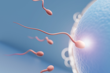 Intracytoplasmic Sperm Injection (ICSI)