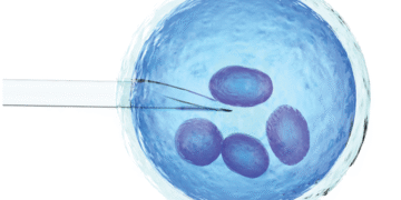 Real Indications for IVF: When Is It Truly Needed?