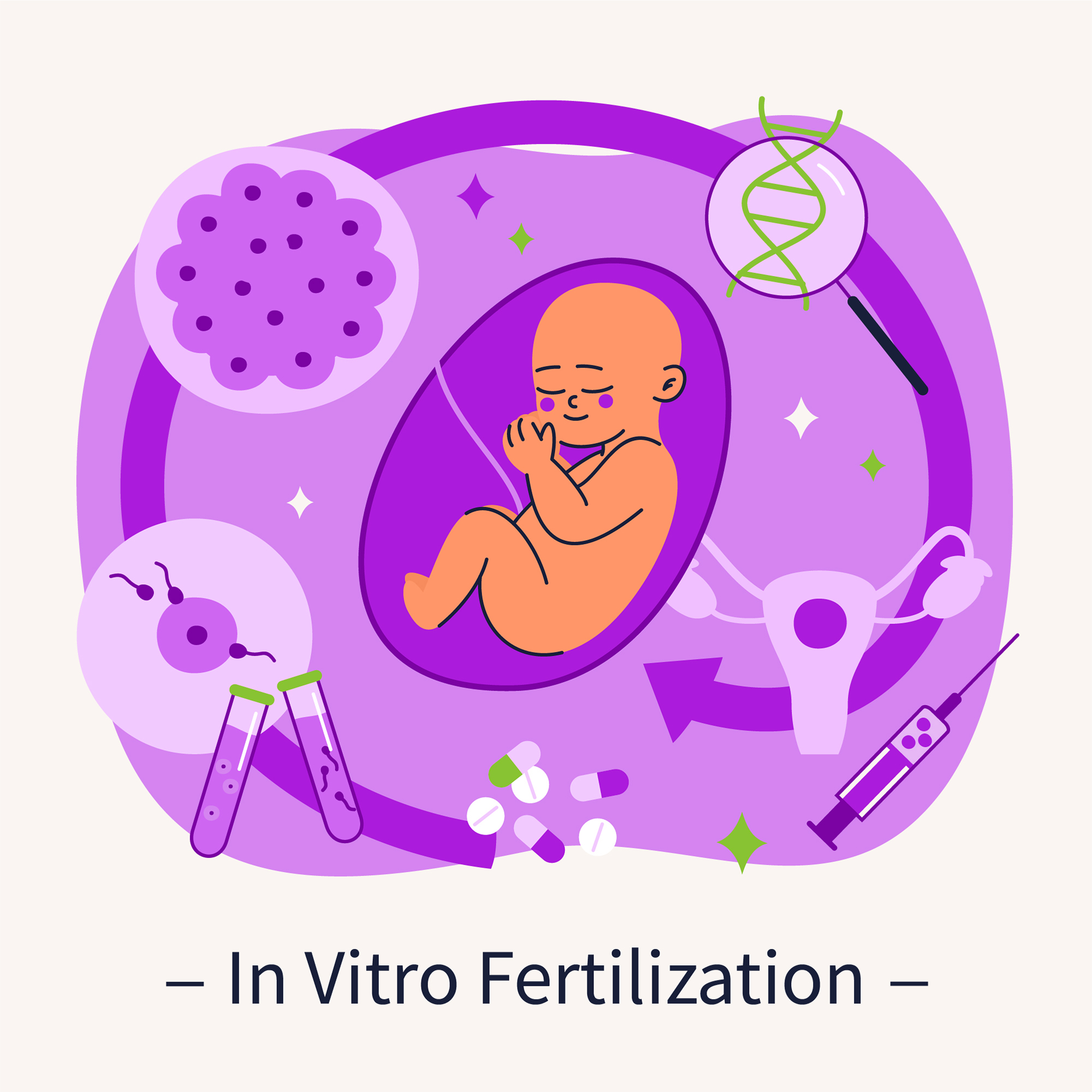 IVF