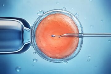 Intracytoplasmic Sperm Injection (ICSI)